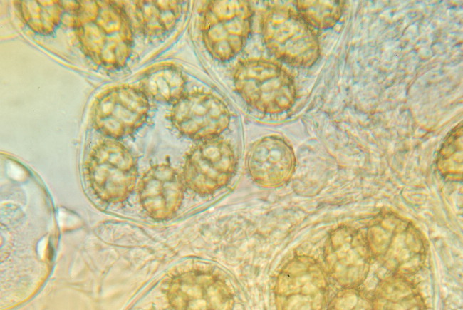 Tuber aestivum